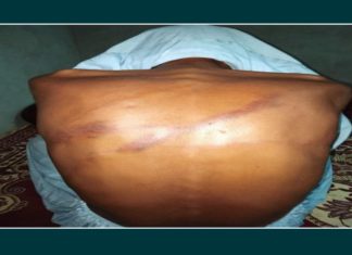 Drug dealers allegedly kidnap, torture 5 citizens in Gwadar