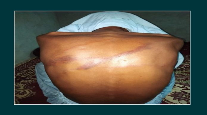 Drug dealers allegedly kidnap, torture 5 citizens in Gwadar